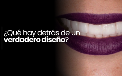Diseño de sonrisa: por qué no se trata simplemente de hacer carillas