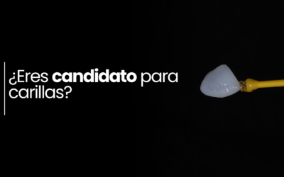 ¿Cuándo necesitas realmente carillas?
