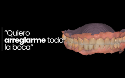 “Quiero arreglarme toda la boca”: ¿qué significa realmente un tratamiento integral?
